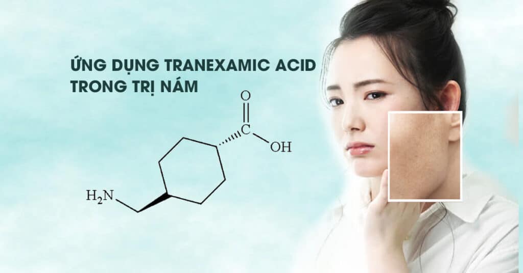 Tranexamic Acid La Gi 2